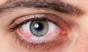 Tips menjaga kesehatan mata untuk yang bekerja di depan komputer