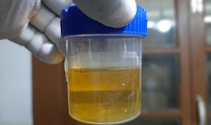 Hasil Tes urin Kecelakaan Mobil Dinas DPRD Jambi