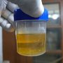 Hasil Tes urin Kecelakaan Mobil Dinas DPRD Jambi