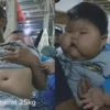 Viral! Bayi Umur 1 Tahun Berbobot 25 kg