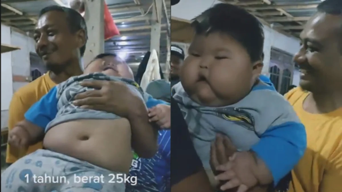 Viral! Bayi Umur 1 Tahun Berbobot 25 kg