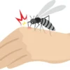 Menghadapi Ancaman Nyamuk Aedes Aegypti pada Musim Hujan