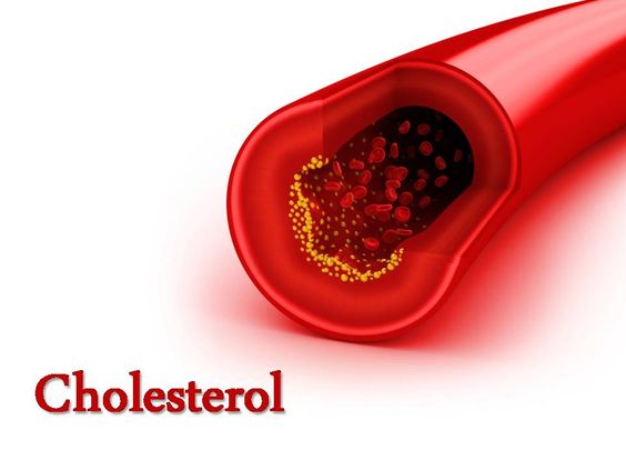Menghadapi Ancaman Kolesterol pada Usia Muda: Pentingnya Kesadaran akan Dampak Jangka Panjang
