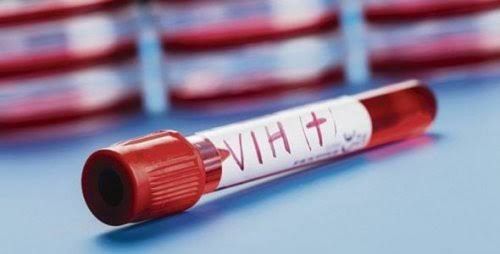 Info Penting !!! Penyebab HIV/AIDS Menurut Dinkes Sumedang & Upaya Tanggulanginya