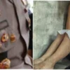Polisi Perkosa Mahasiswi di Mataram Resmi Jadi Tersangka