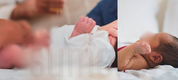 Mengenal Sunat Bayi Perlukah dan Bagaimana Prosedurnya? Seperti Ini Penjelasan Dokter